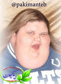 چگونه از غبغب خلاص شویم؟