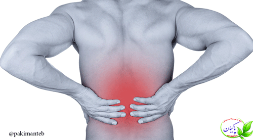 این نوع کمر درد نشانه ی ابتلا به سیاتیک است