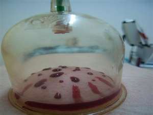 حجامت درمانی